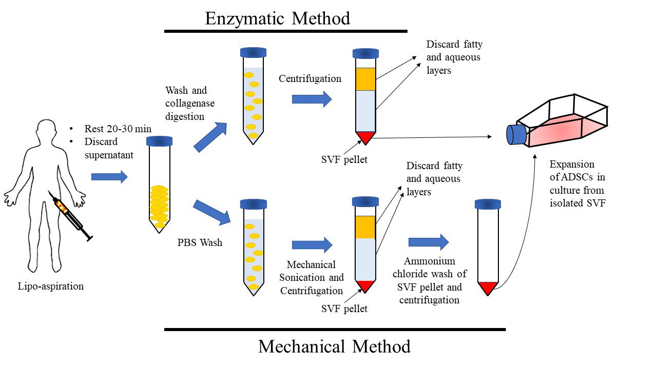 Nano-Fat & Adipose-Derived Stem Cells
