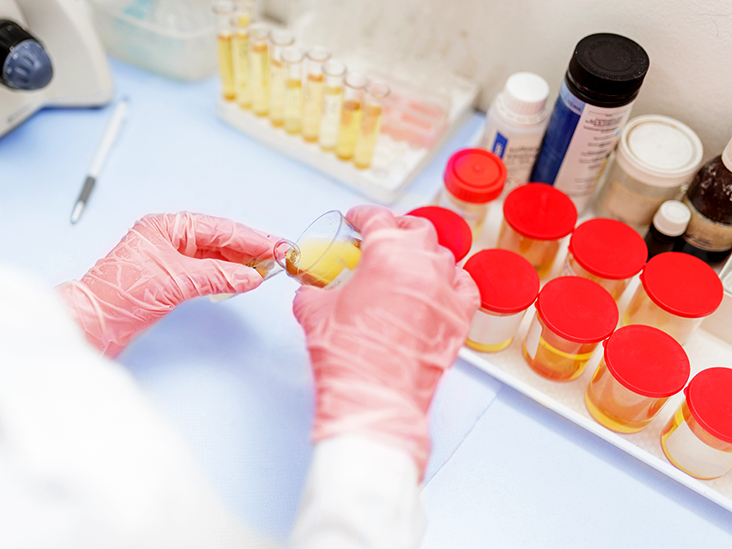 Drug & Alcohol Testing