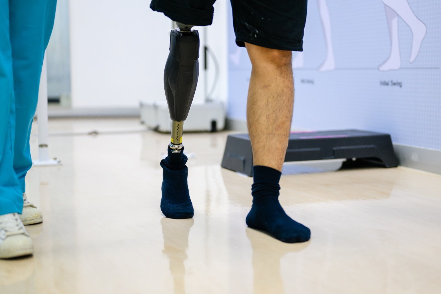 Post-Amputation Pain