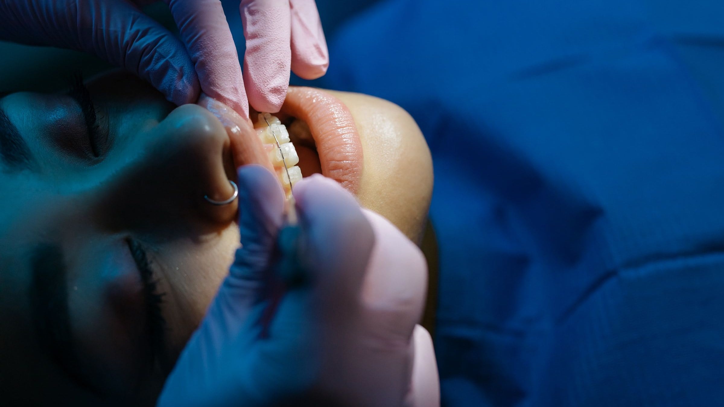 What to Do When a Tooth Gets Knocked Out: A Step-by-Step Guide