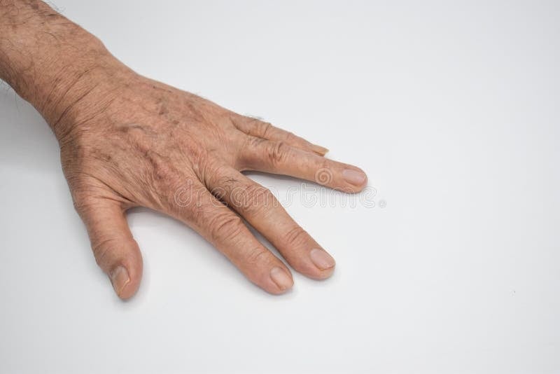 Spasticity-Related Pain