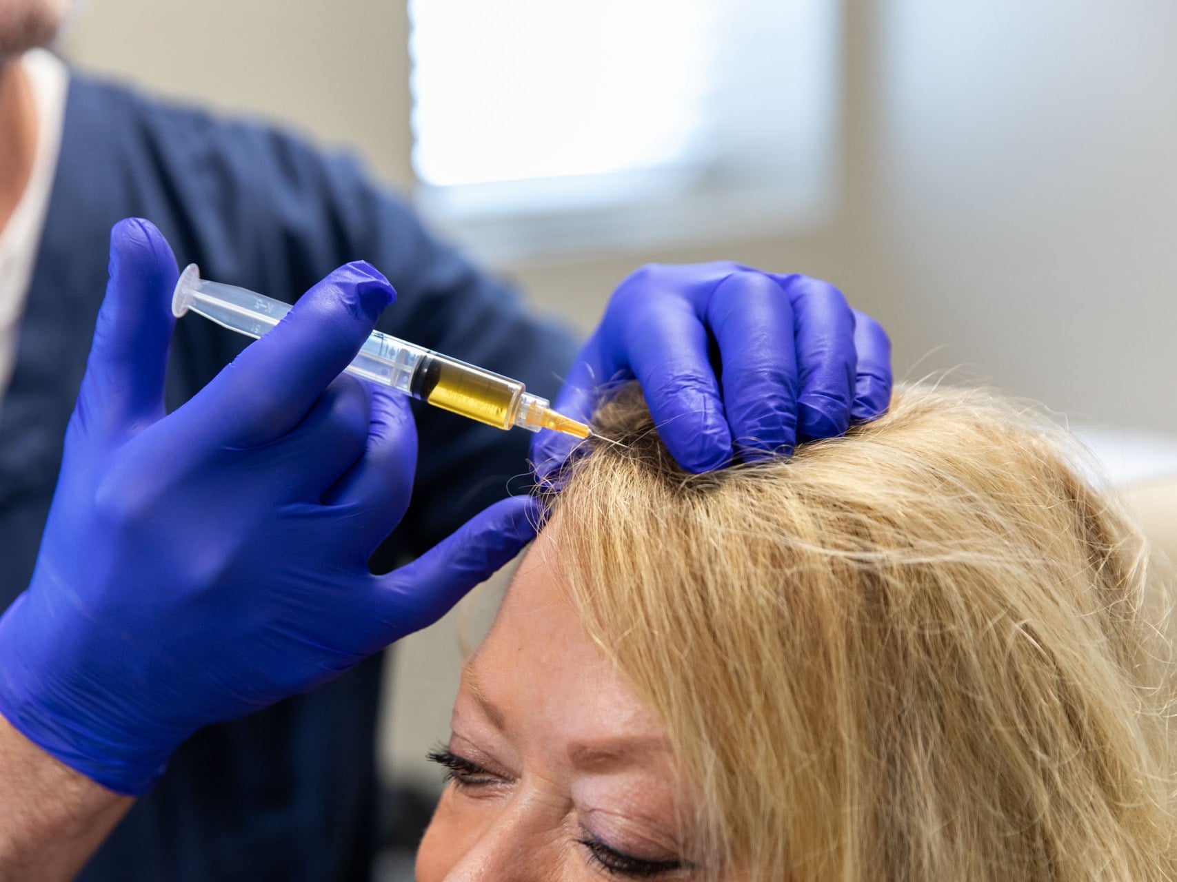 Hair Restoration at Precision Health & Wellness