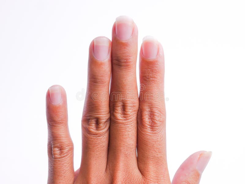 Nail Health