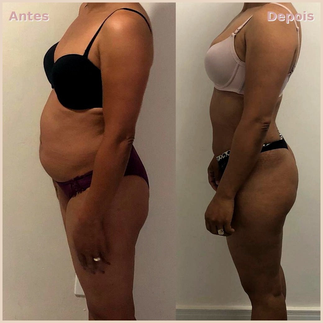 Transformação Lateral