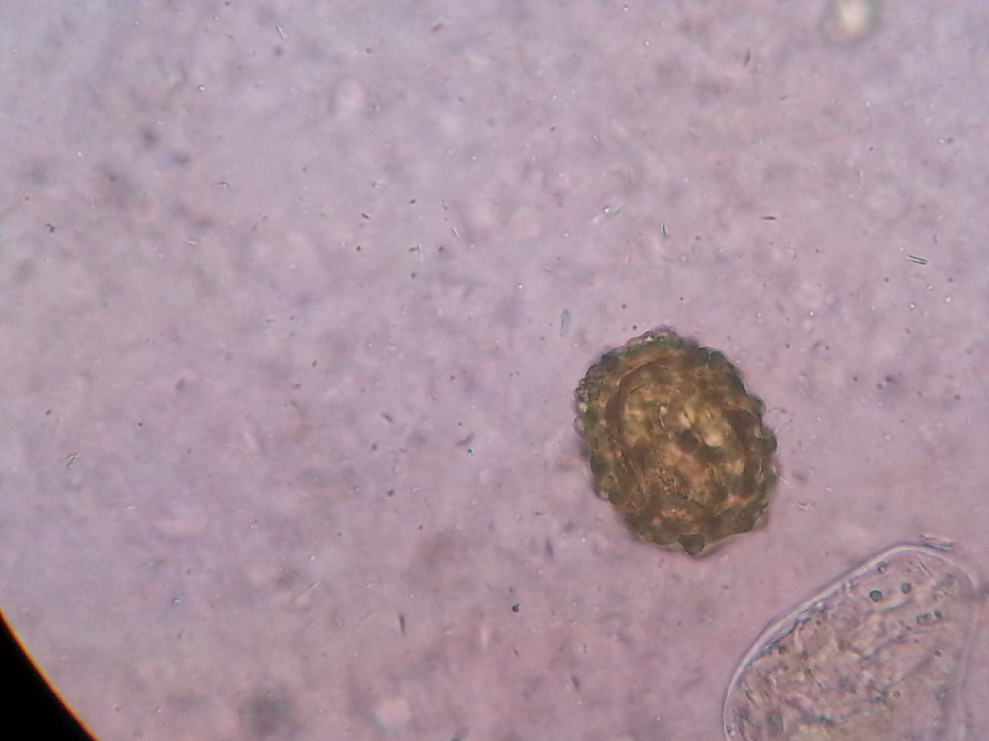 Telur Ascaris lumbricoides di bawah mikroskop