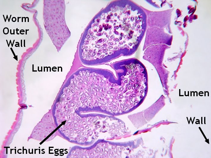 Cacing dewasa Trichuris trichiura