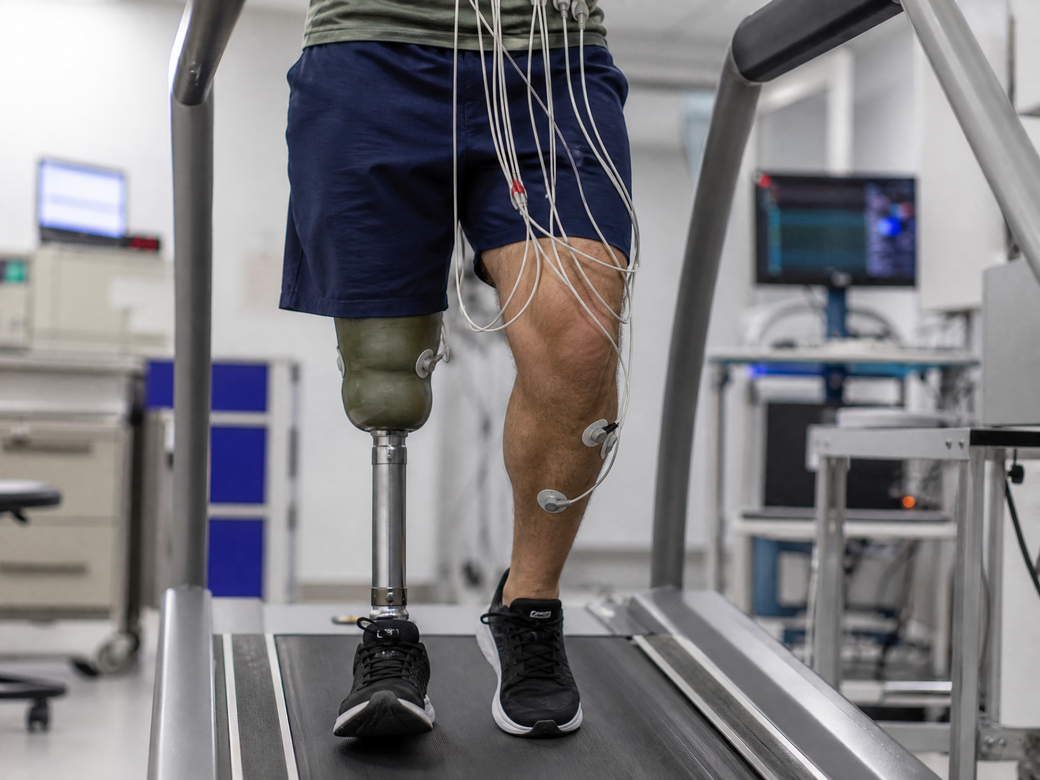 Close-up of a veteran legs on a medical treadmill with ECG electrode wires visible during a cardiac stress test in a clinical laboratory