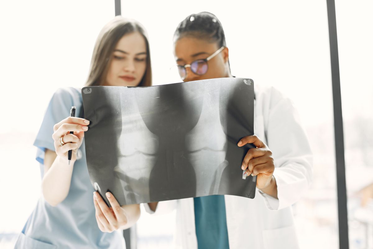 Two medical professionals holding up and examining a shoulder X-ray film against the light, reviewing the joint for structural pathology