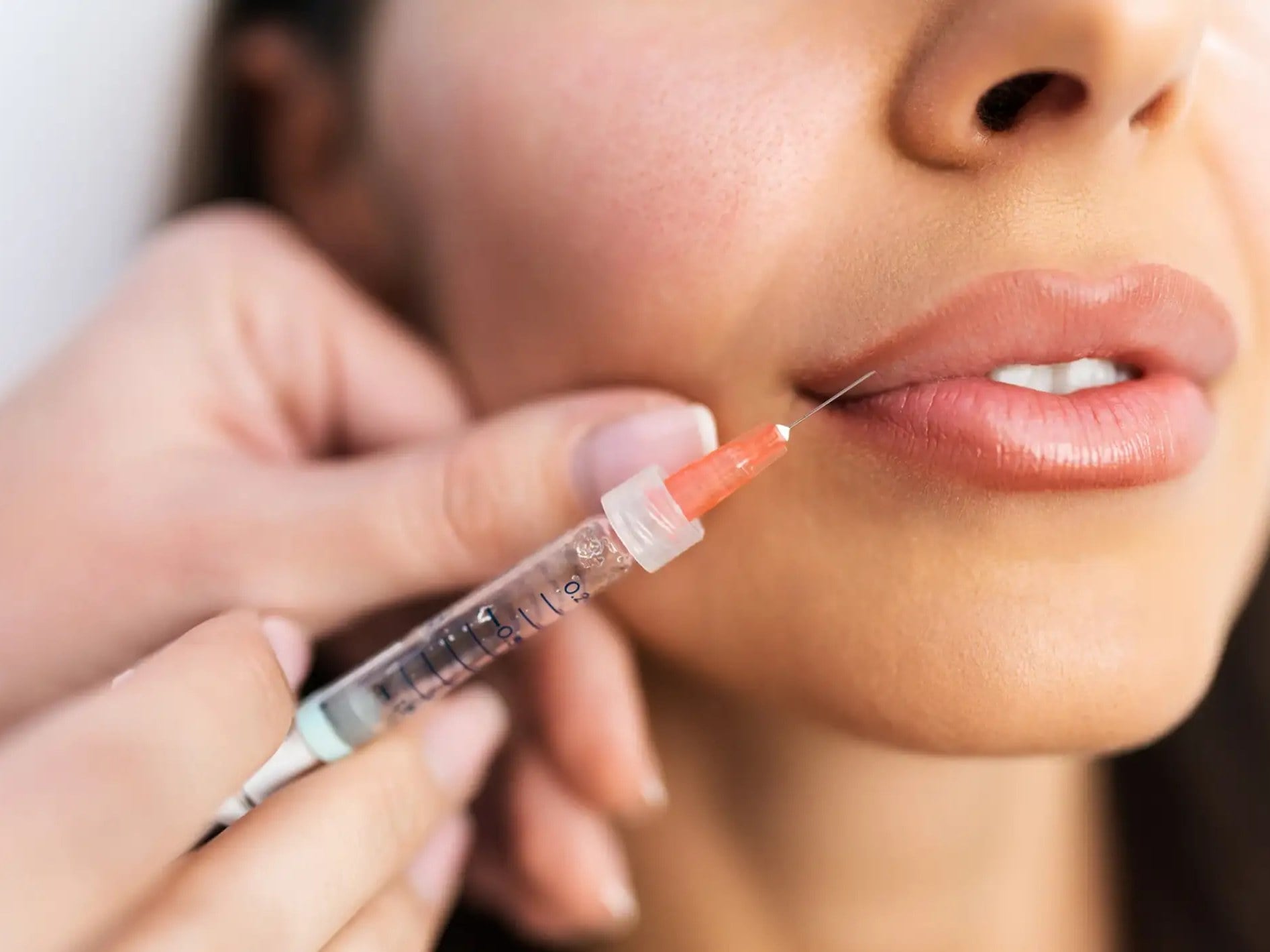 Dermal Fillers at Precision Health & Wellness