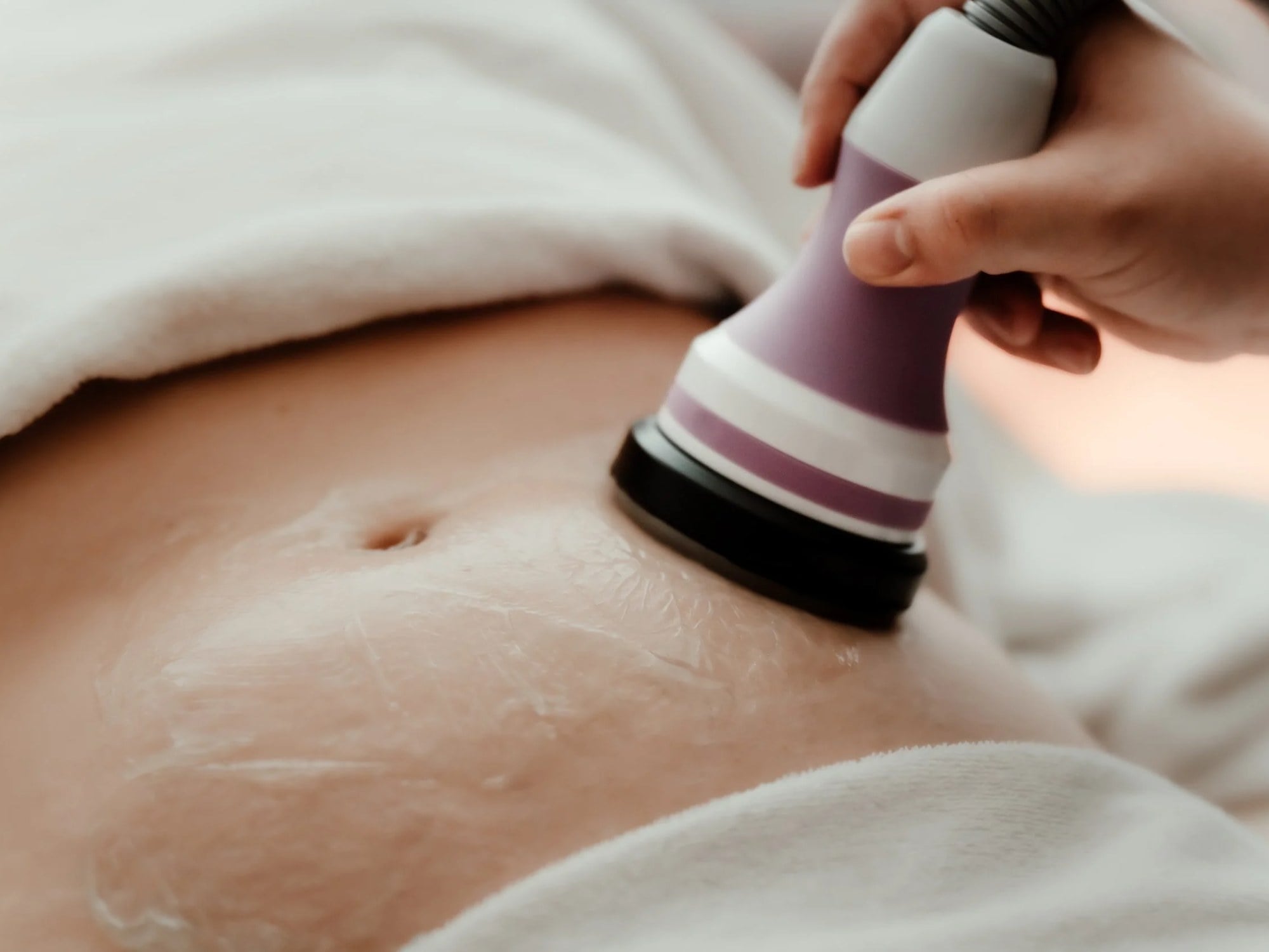 Body Contouring at Precision Health & Wellness