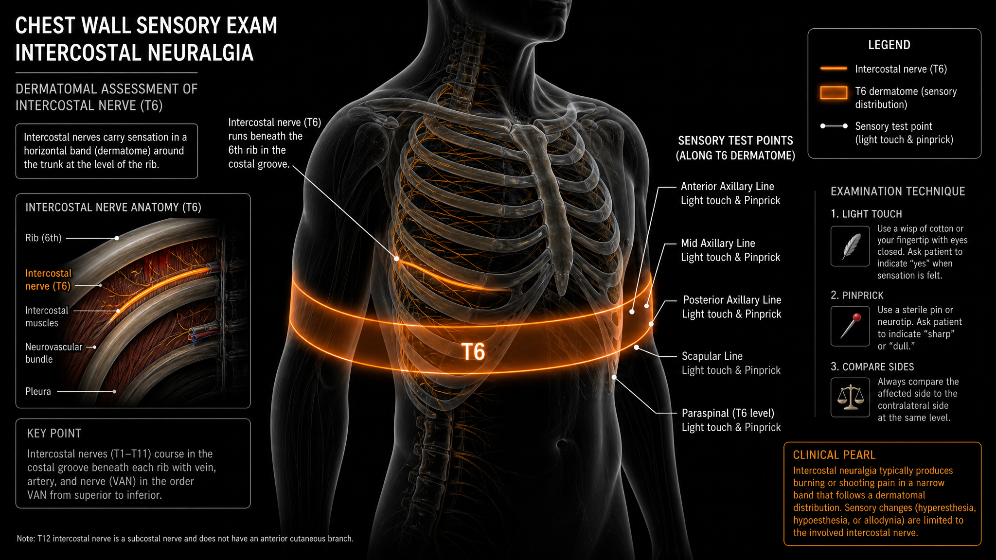 Dark labeled teaching diagram of the chest-wall sensory exam, showing the intercostal nerve under a rib and the thoracic dermatomal band tested with light touch and pinprick