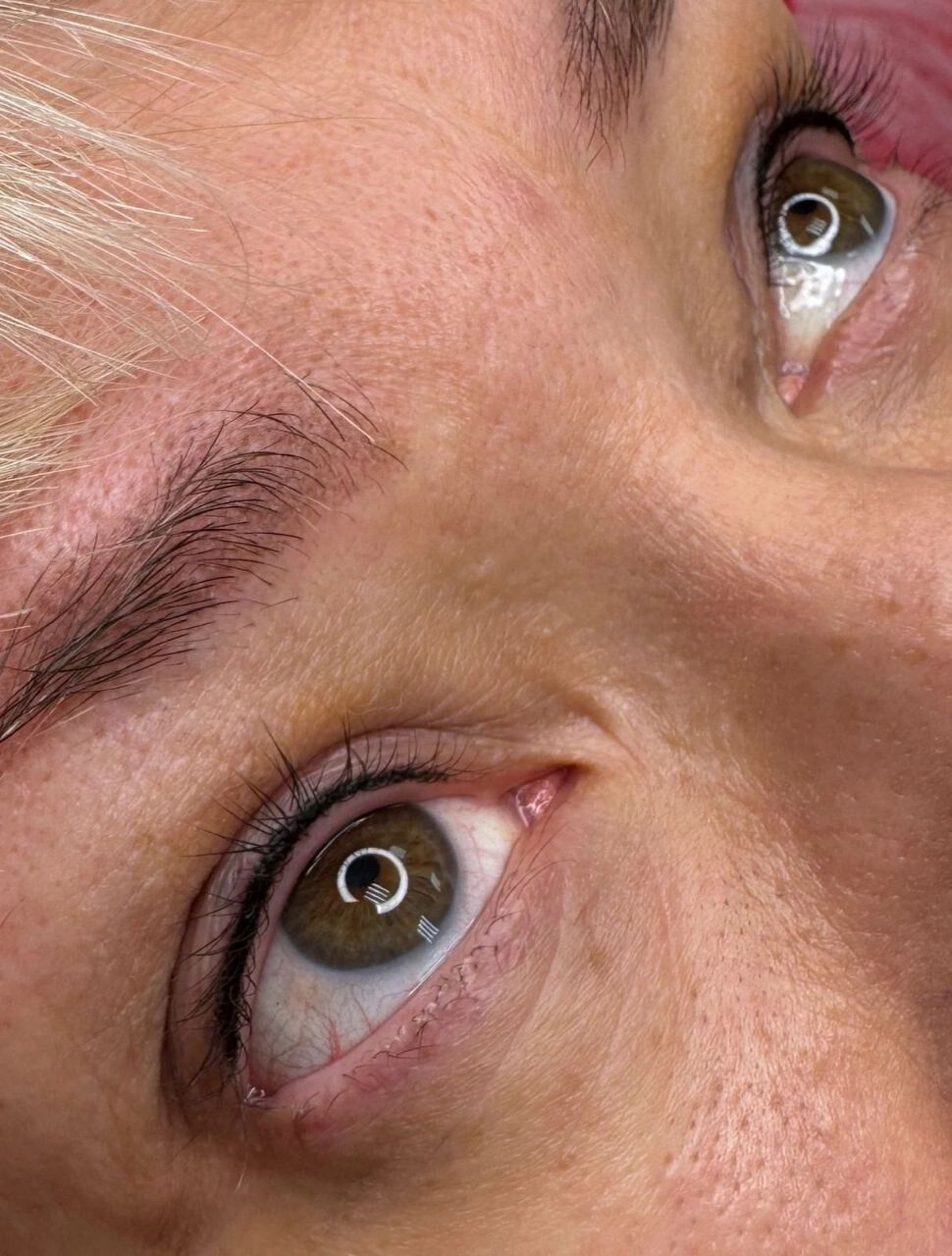 Результат работы: Межресничка