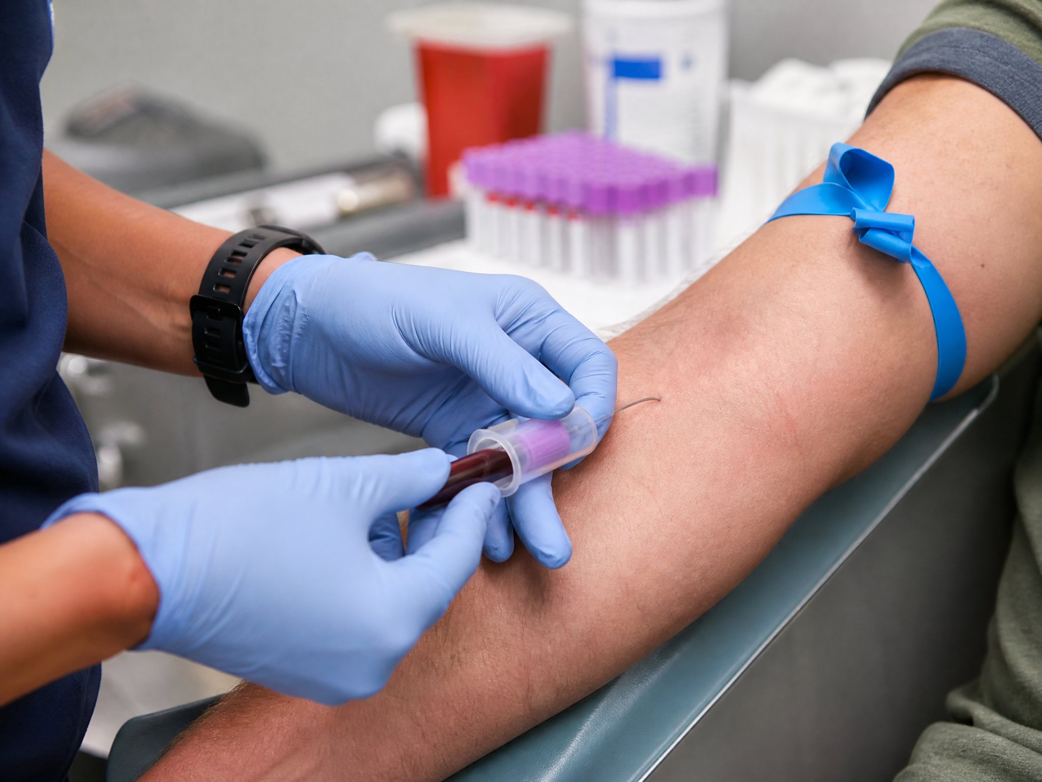Close-up of a blood draw from a veteran arm with a gloved hand holding a vacutainer for cardiac biomarker testing