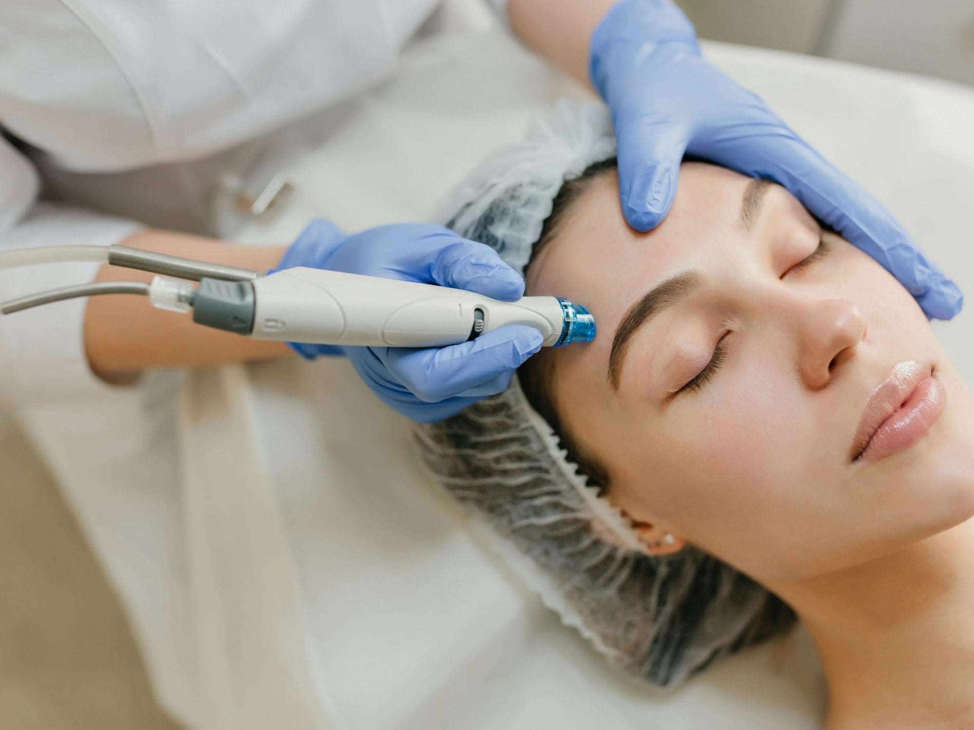 Microneedling Treatment at Precision Health & Wellness