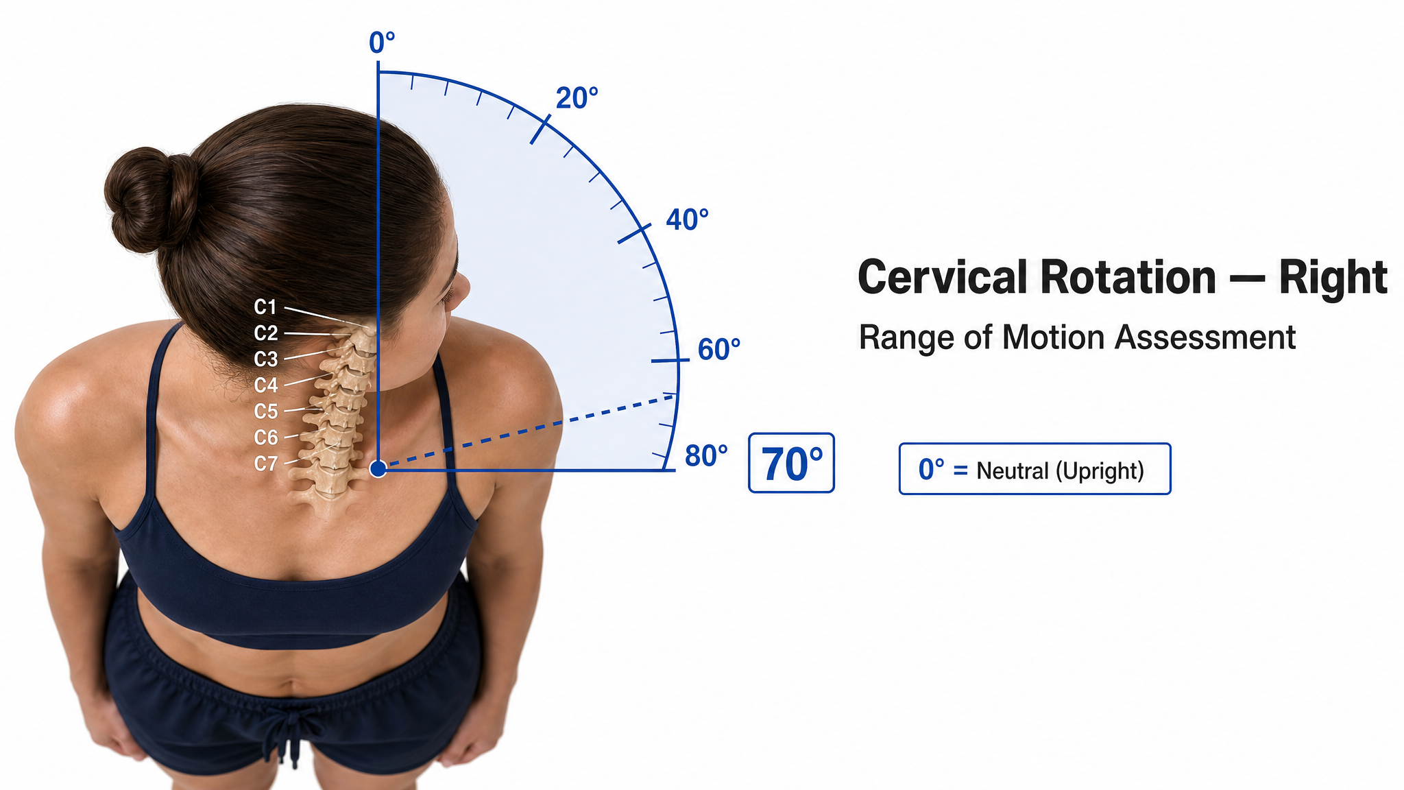 Clinical illustration of right cervical rotation viewed from above — a female figure turning the chin toward the right shoulder with the C1–C7 spine overlaid and a goniometer protractor arc measuring the angle