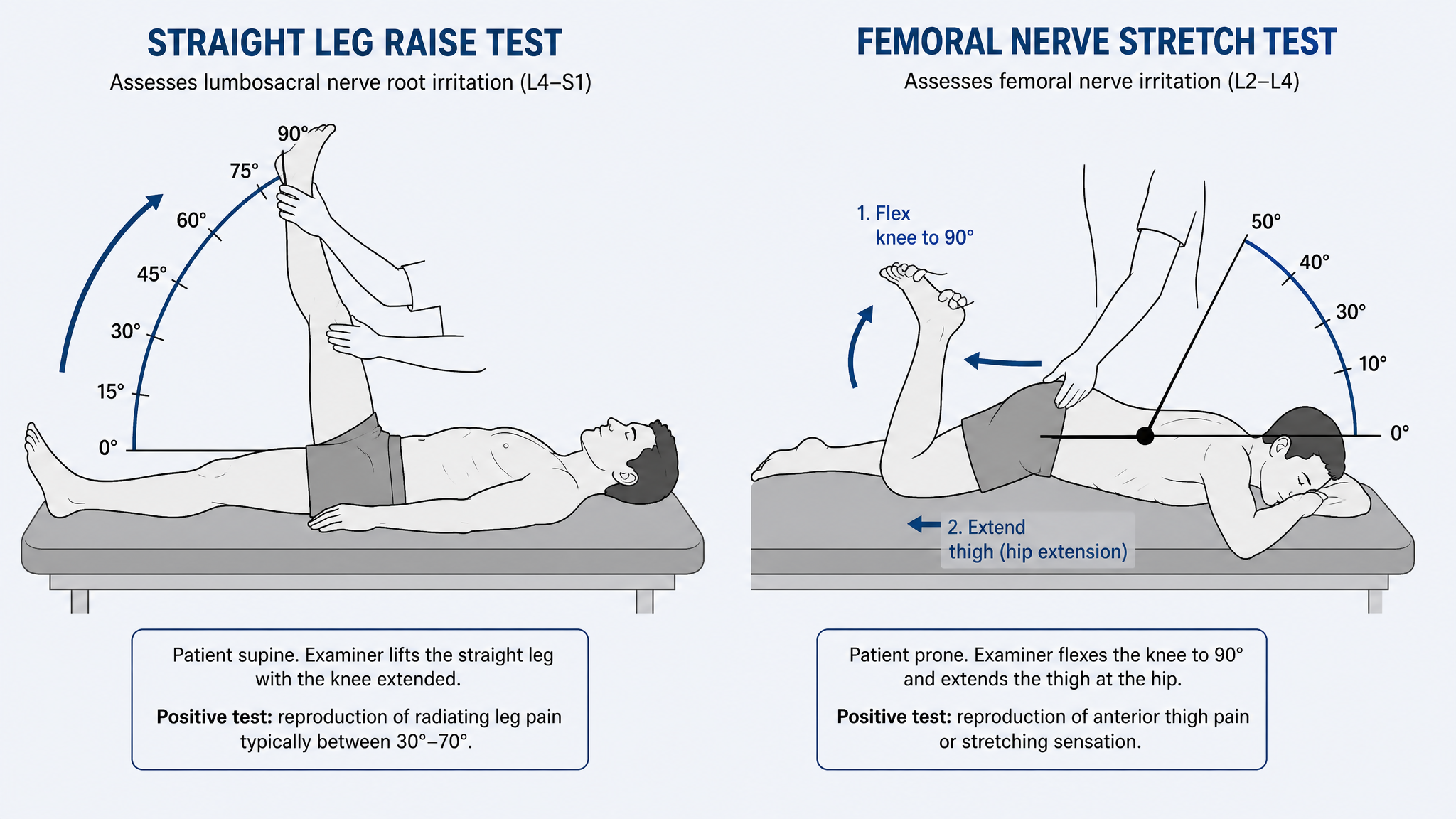 Clinical diagram showing the straight leg raise test performed supine with a hip angle arc marked in degrees beside the femoral nerve stretch test performed prone with the knee flexed and the thigh extended