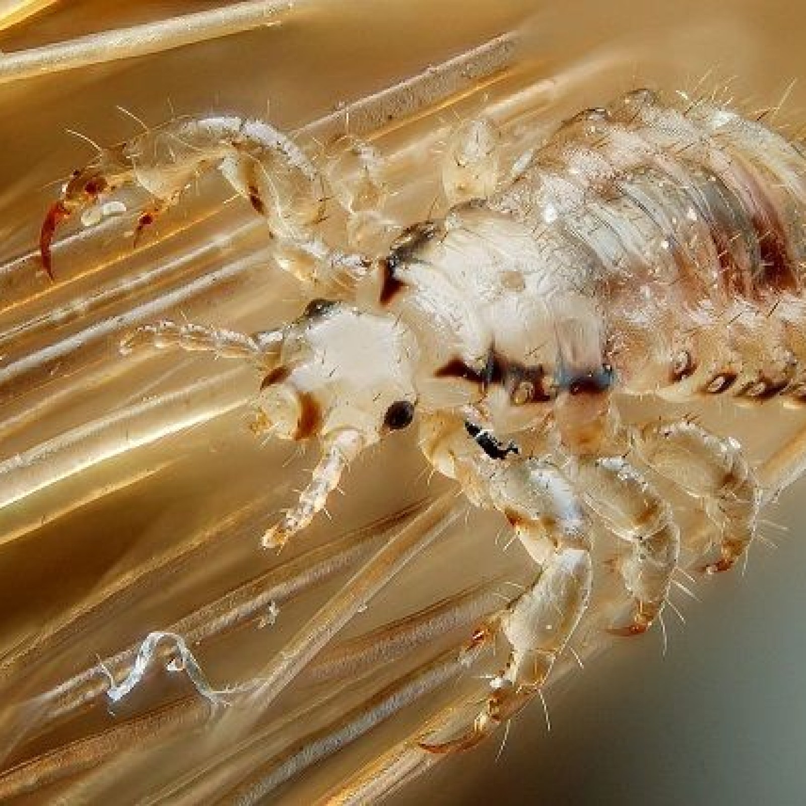 Lice