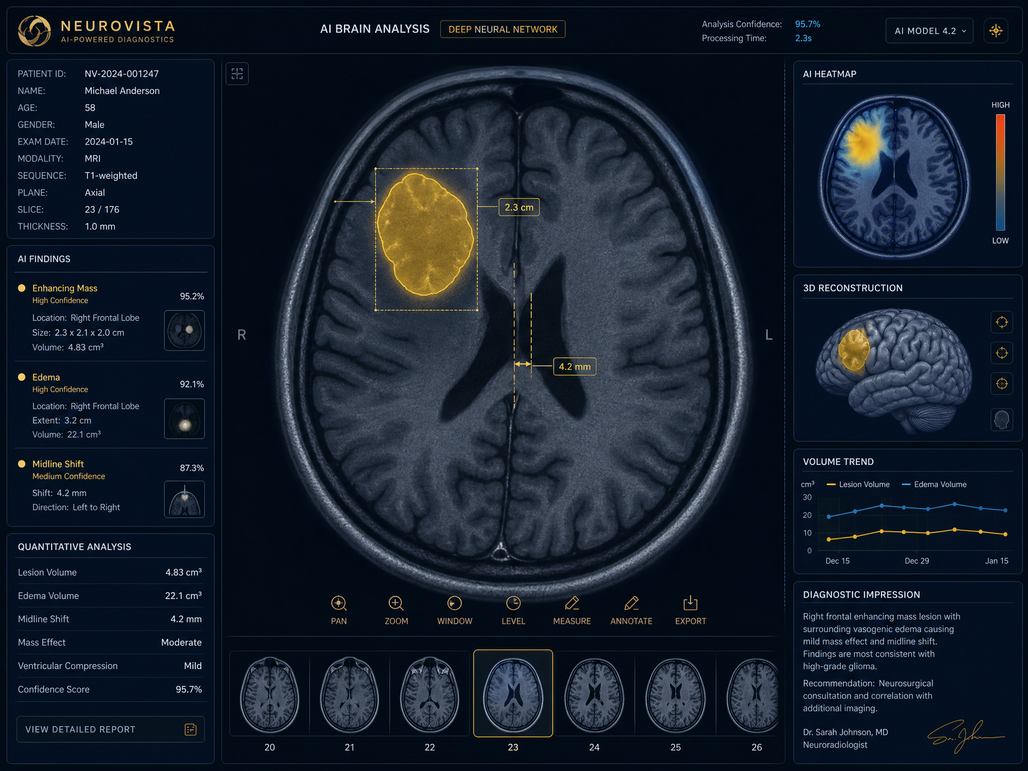 Radiology CT scan with AI analysis overlay