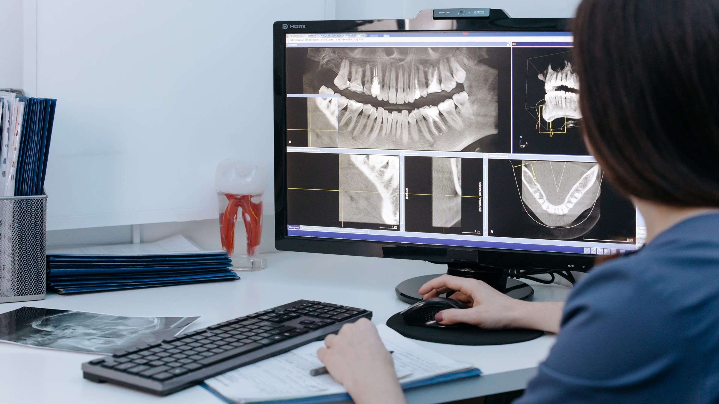 Emergency Root Canal