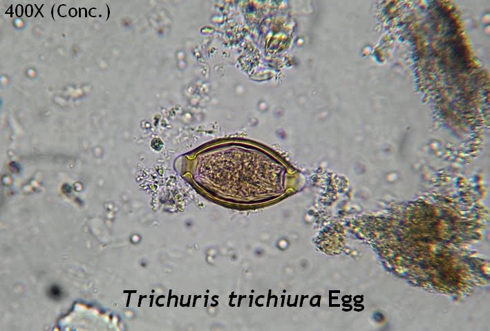 Telur Trichuris trichiura berbentuk tempayan