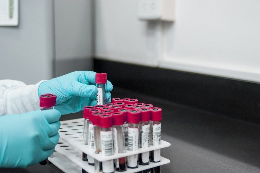 DNA Testing