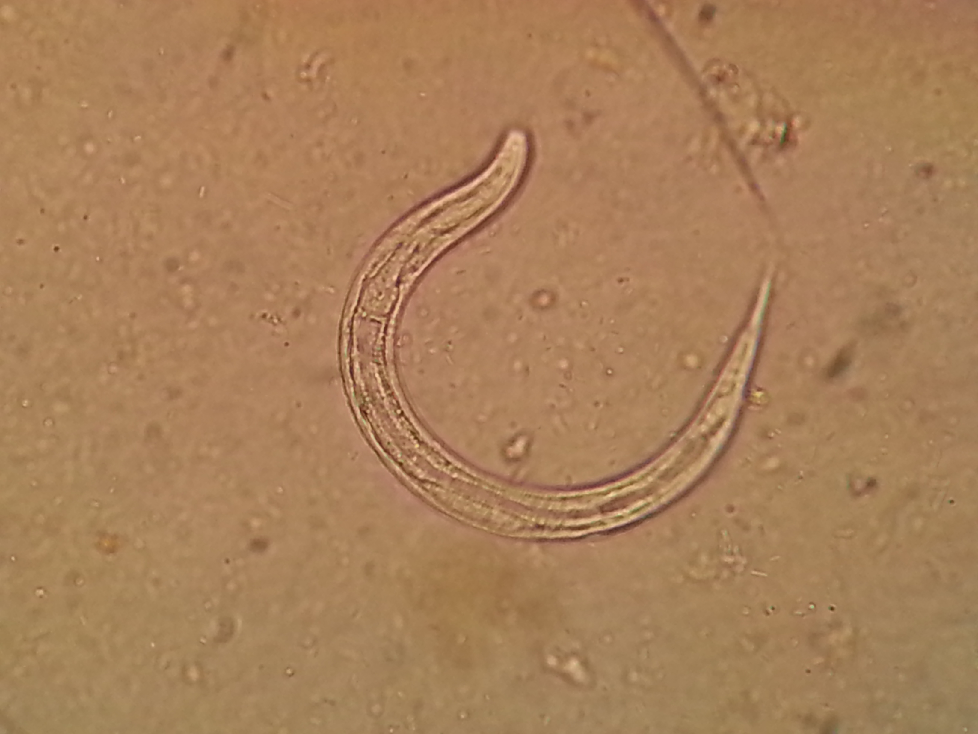 Larva Strongyloides stercoralis