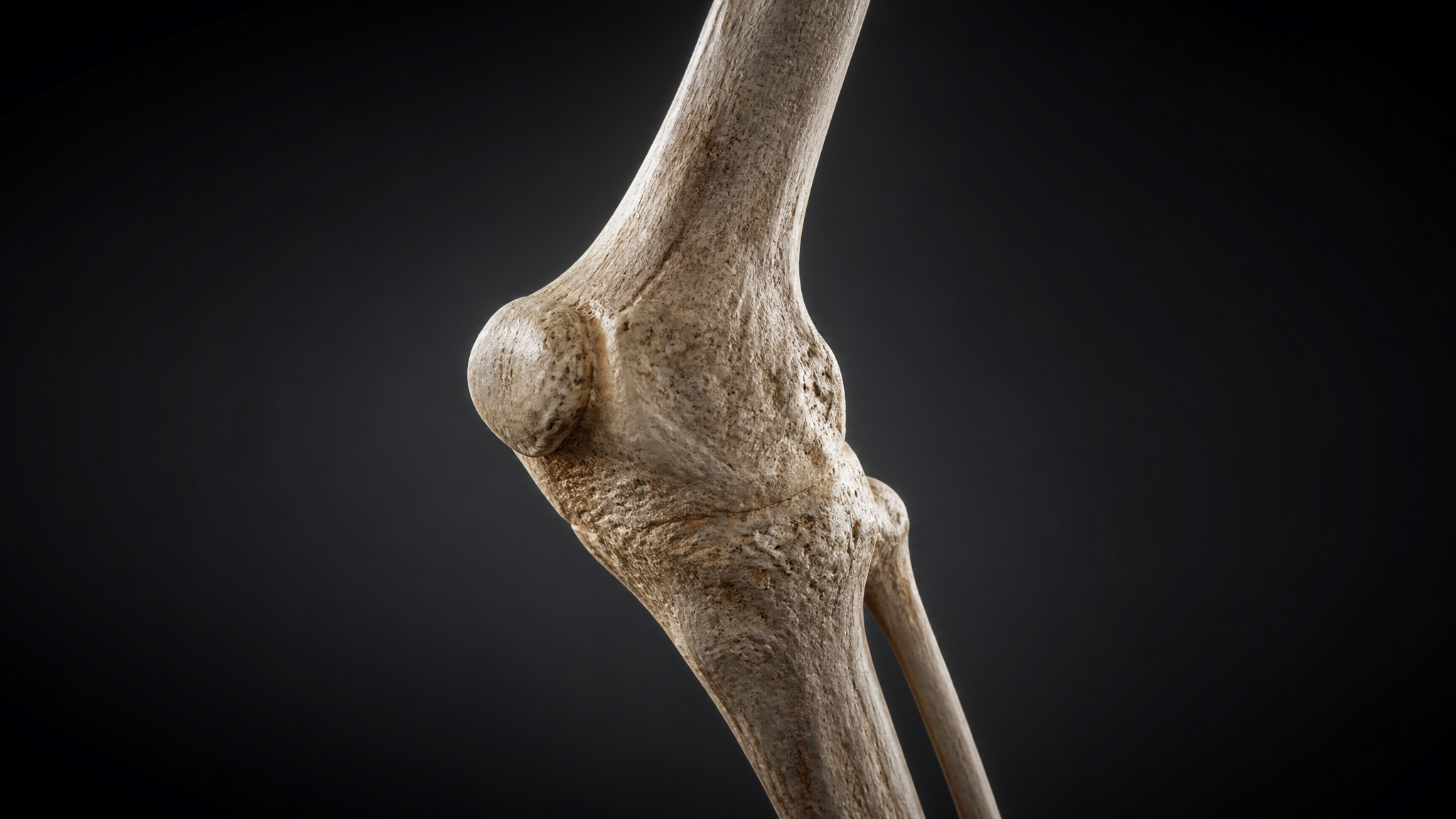 3D anatomical render of the knee joint bones held at a fixed angle in a dark cinematic setting, with no labels or markings